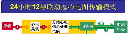 远程网络传送24小时12导联动态心电图分析系统