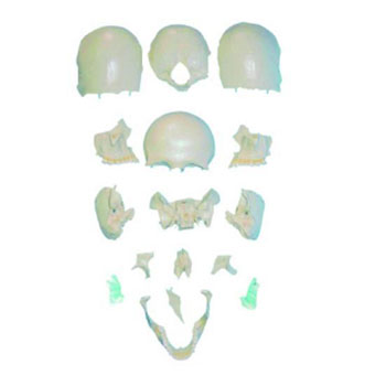  分离头颅骨散骨模型KAR/11117-2