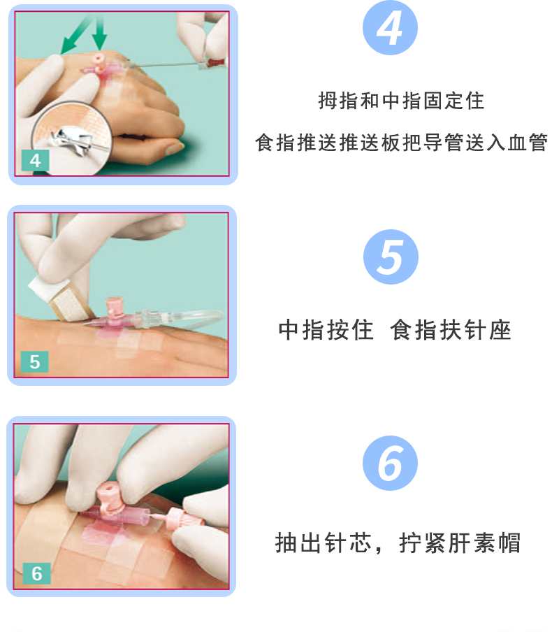 沃素安20G动静脉留置针